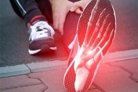 Foot Problems in Runners